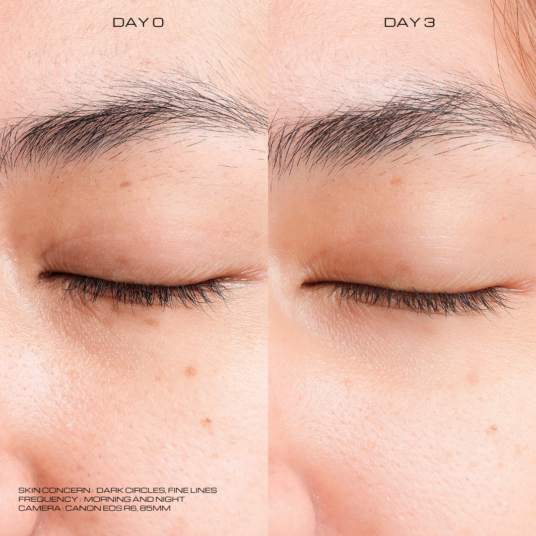 Awakening Lift - Original Packaging