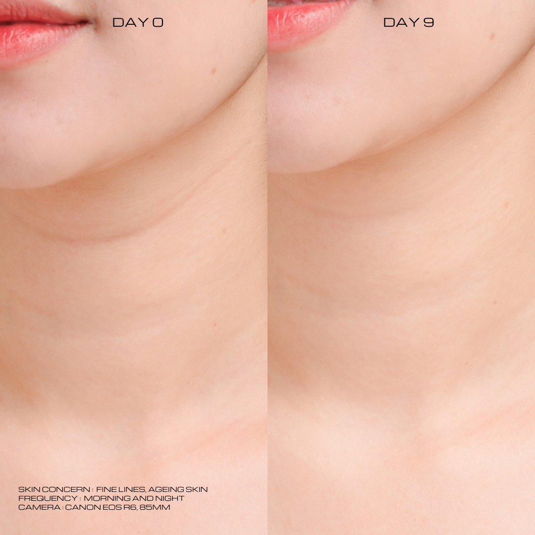 Skinfill Cream - Original Packaging