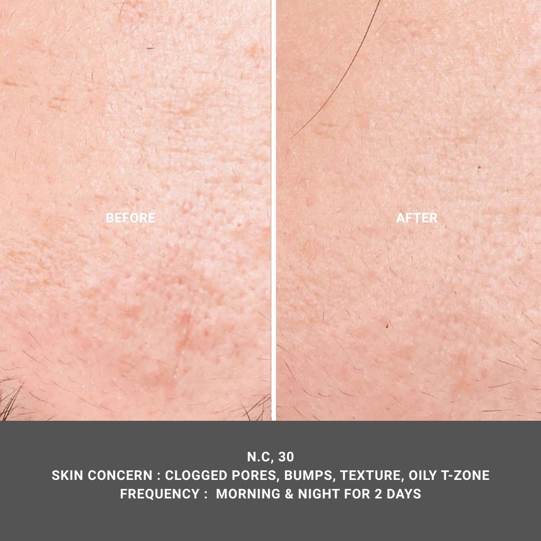 Texture Aid