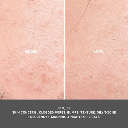 Texture Aid