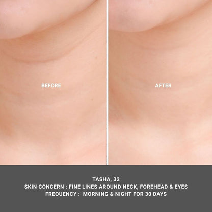 Skinfill Cream