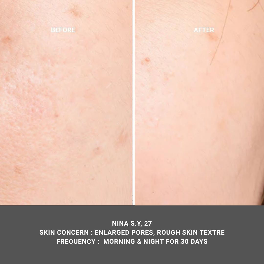 Botanical Gel Cleanser