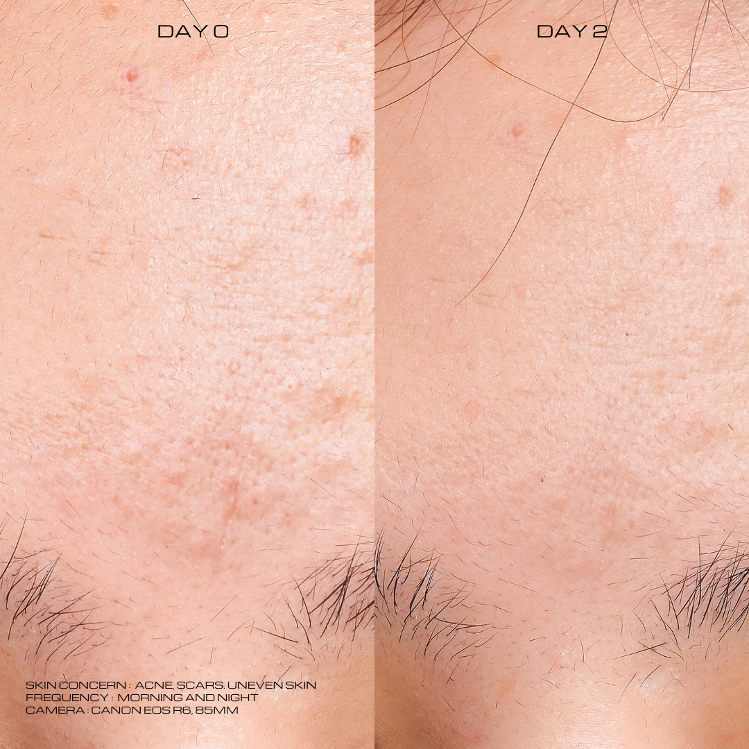Texture Aid